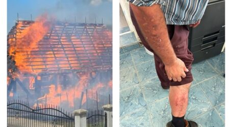 FOTO. Cum arată un erou din Cizer, după lupta cu flăcările