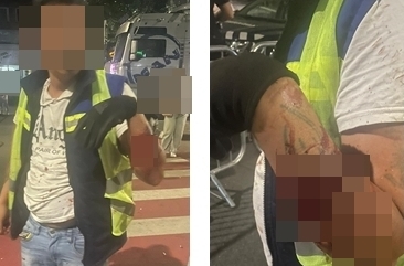 Citadin Salubrizare, SPRIJIN pentru angajatul bătut cu bestialitate la Zilele Zalăului. Care e starea victimei